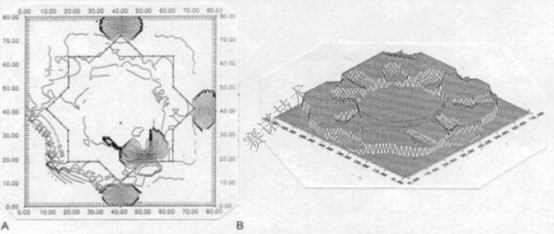 鄭賽抗震加固系統(tǒng)